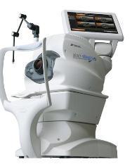 OCT maculaire RNFL nerf optique ganglionnaire