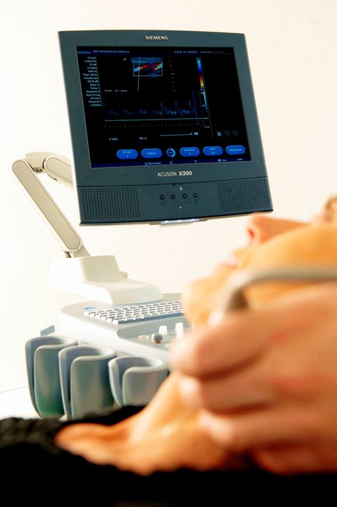 Neurosonographie