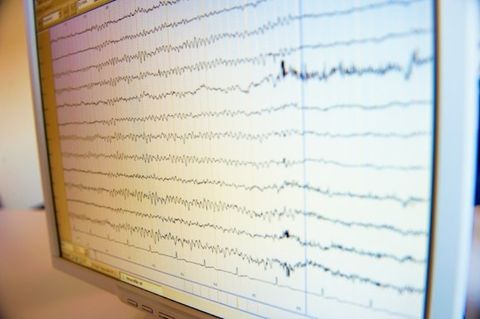EEG (Elektroenzephalographie)