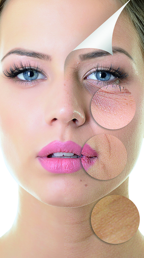 Hautverjüngung und Kollagenstimulation durch Plasma Pen