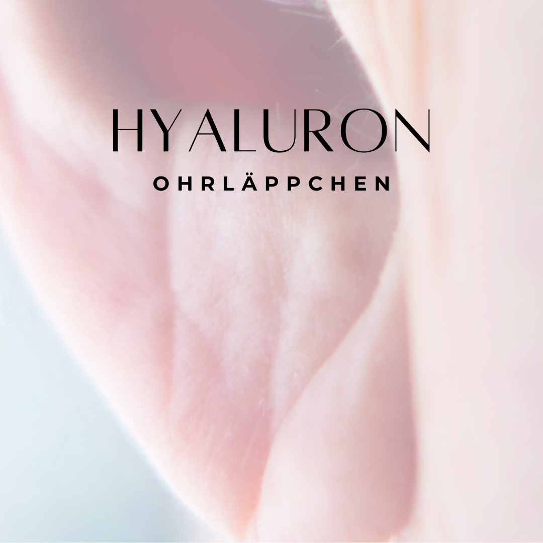 Ohrläppchen korrigieren mit Hyaluron bei Dr. Stolz-Fink (HNO-Arzt und Experte für ästhetische Medizin) in Kastellaun bei Simmern, Hunsrück, Rheinland-Pfalz Ohrläppchen-Chirurgie.