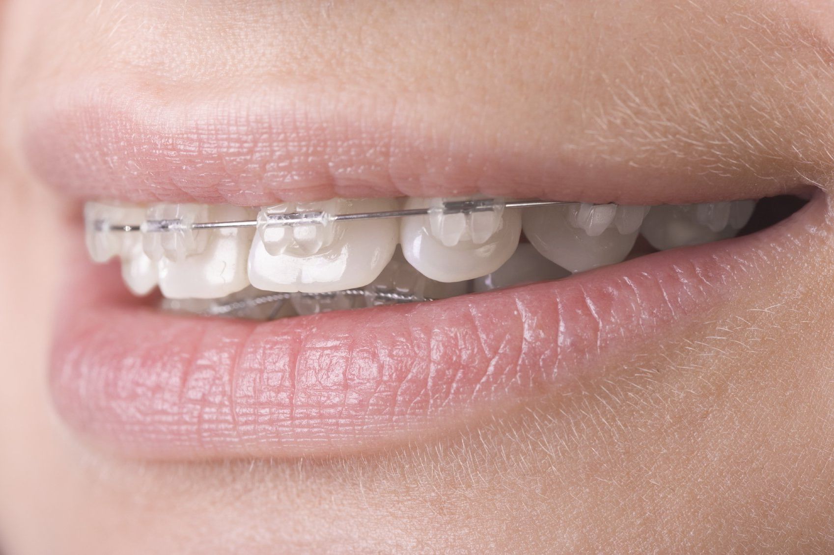 Beratung Zahnarzt Beratung bei Doz. DDr. Heinz-Dieter Müller, PhD