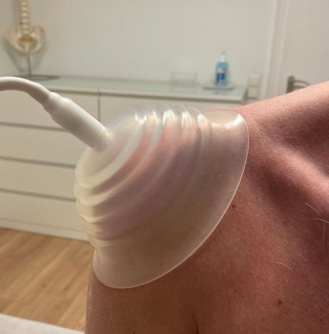 Erfahren Sie mehr zur pneumatischen Pulsationstherapie... Pulsationstherapie der Schulter