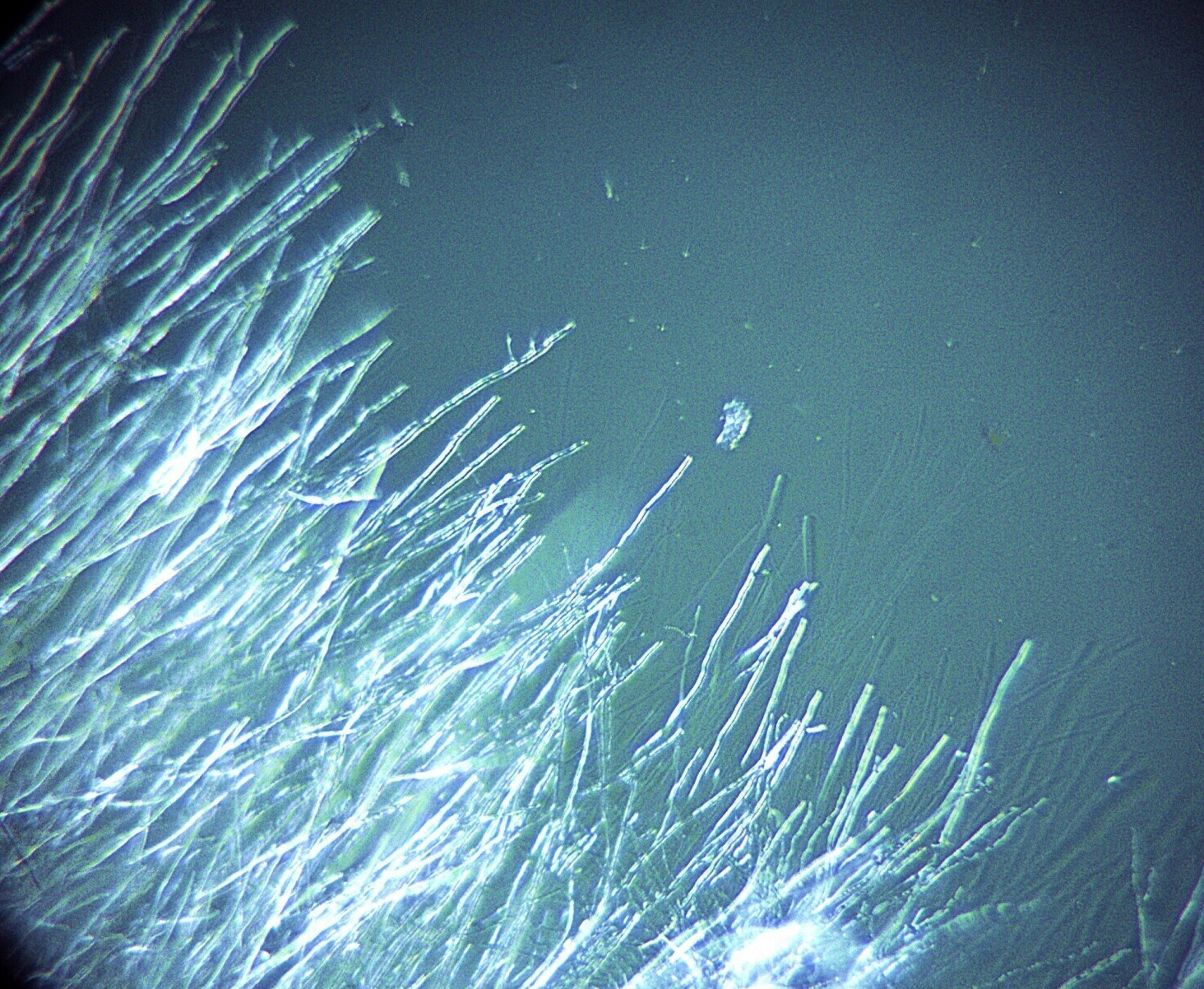 Schimmelmyzel im Wachstum Schimmel Myzel