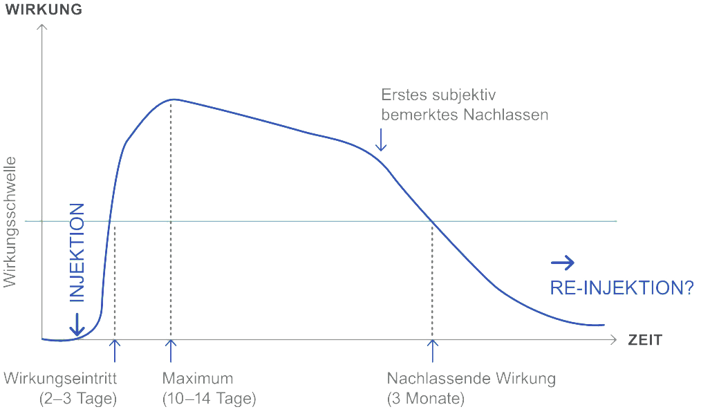 Wirkprofil von BoNT A zwischen Injektion und Reinjektion Wirkprofil von BoNT A zwischen Injektion und Reinjektion