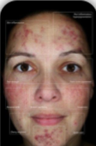 HGFace - Observ520x Cross Polarised