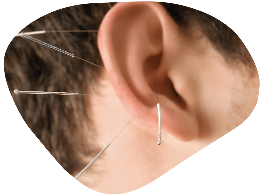 Autogenes Training (AT) Ohrakupunktur bei Anja Lehnert