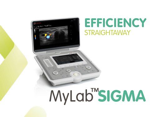 ESAOTE MyLab Six Farbdoppler ESAOTE MyLab Six Farbdopplersystem