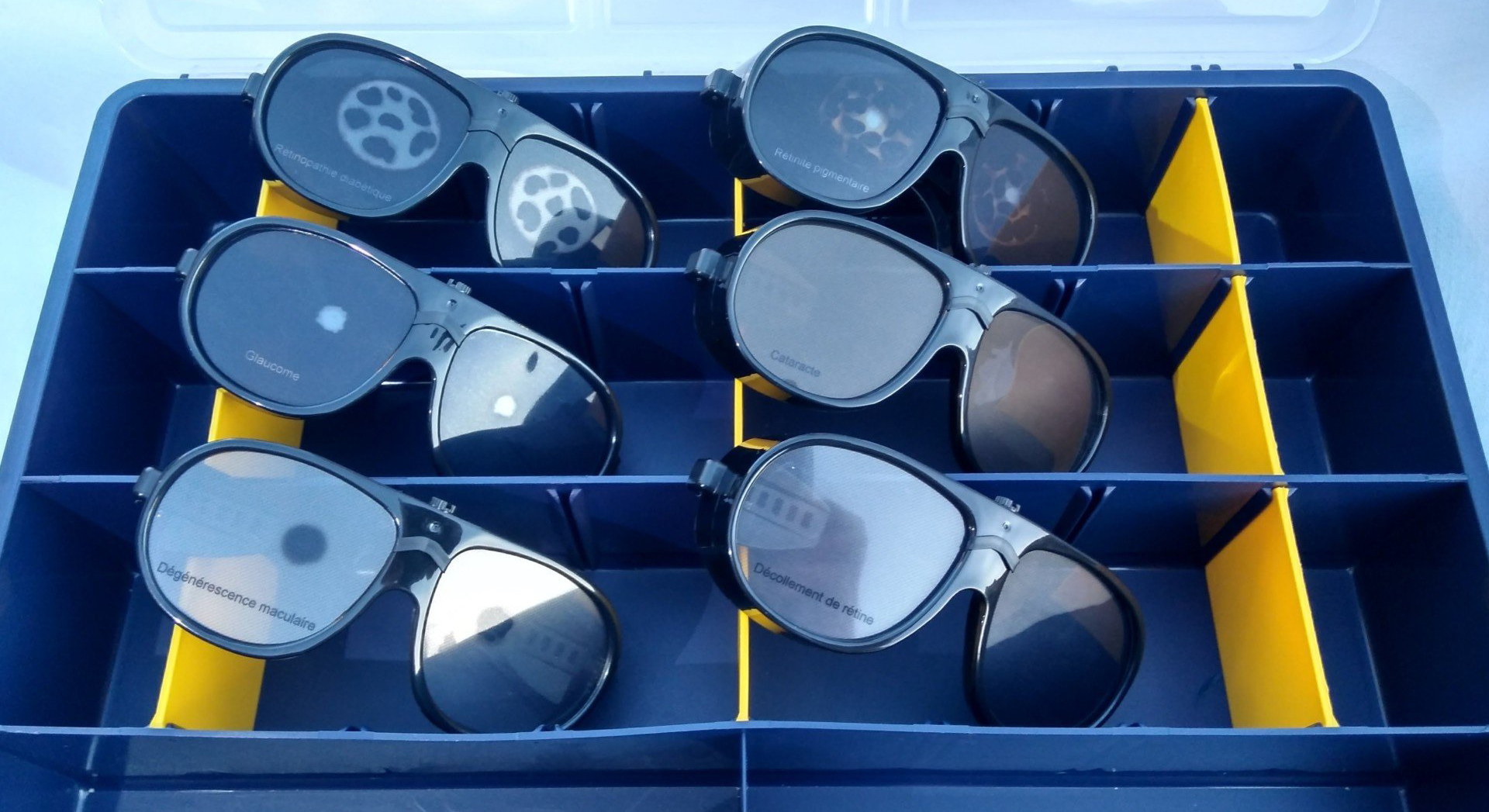 Personnes agees quel examen pour la cataracte