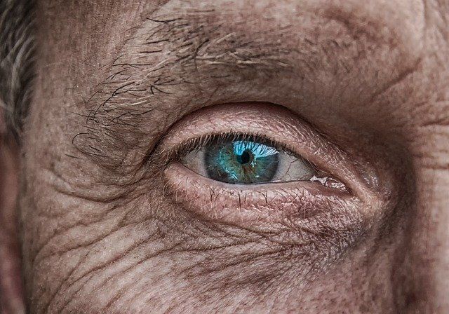 pathologie visuelle