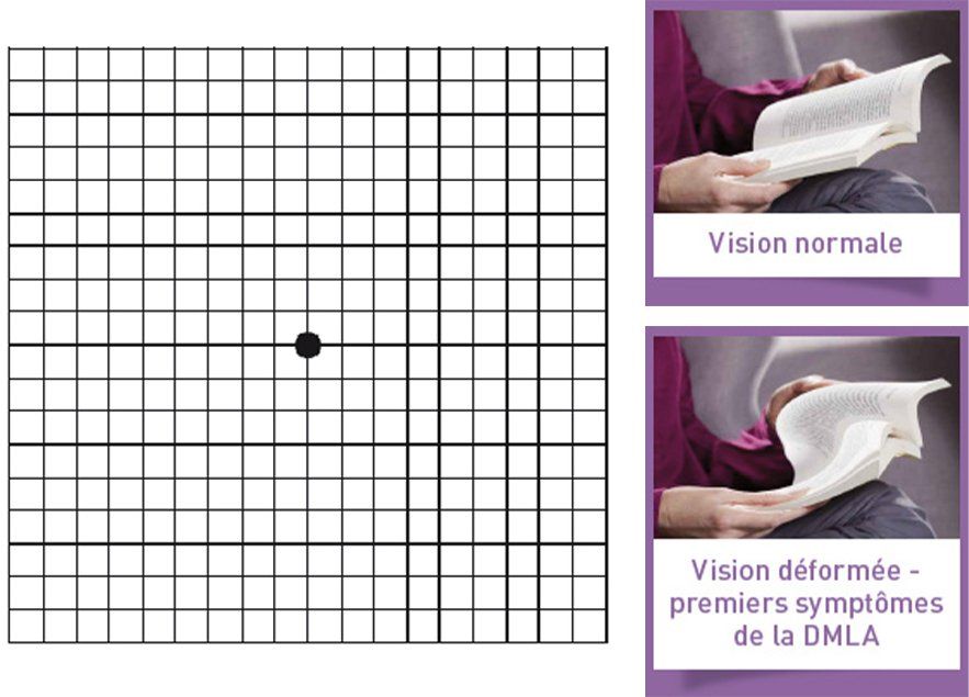 Test DMLA - Opticiens Bardin