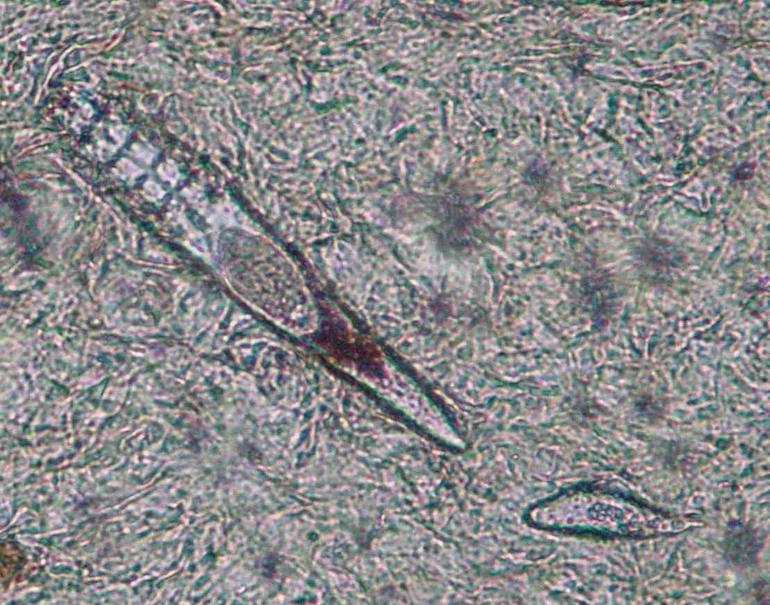 Demodex, acarien observé au microscope