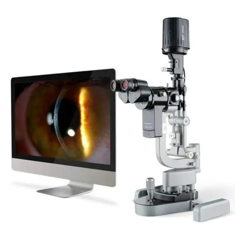 Illustration de la biomicroscopie avec lampe à fente pour l'examen détaillé des structures oculaires