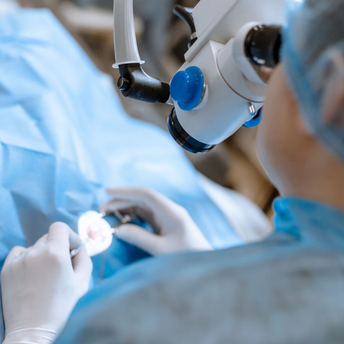 Illustration de la chirurgie du cristallin avec implant de cataracte, une procédure courante pour restaurer la vision