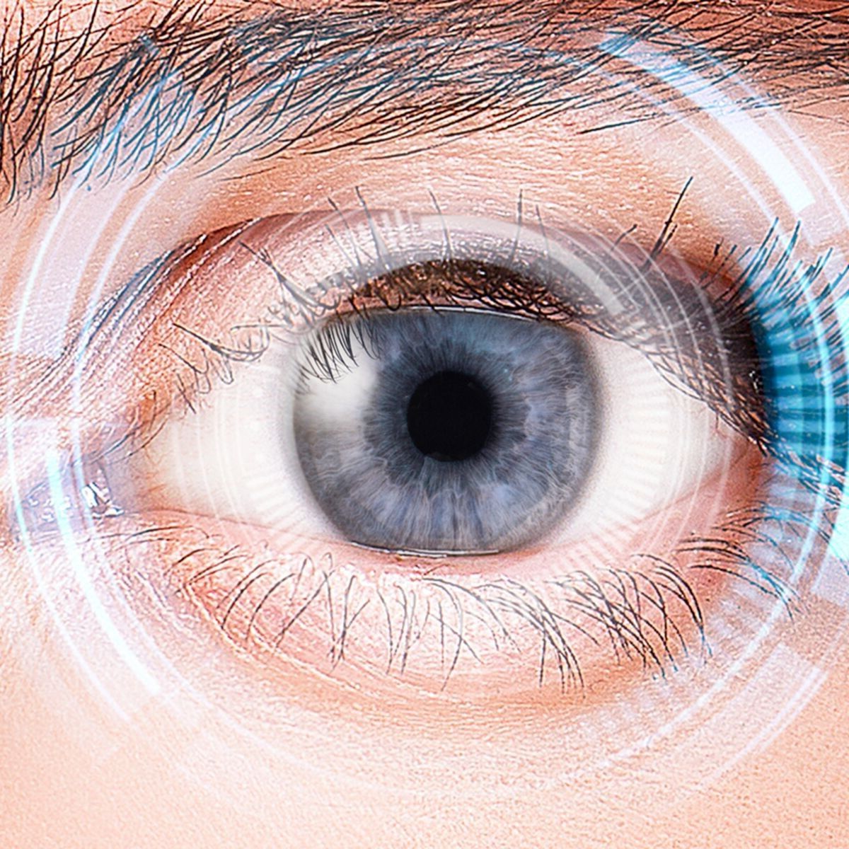 Illustration d'une déchirure de la rétine ou d'un trou rétinien, des affections oculaires pouvant nécessiter un traitement médical urgent