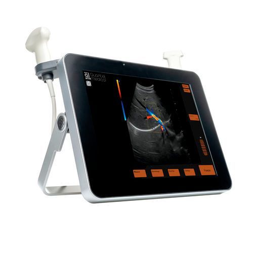Illustration de l'échographie haute fréquence (UBM), une technique d'imagerie médicale utilisée en ophtalmologie pour visualiser les structures oculaires antérieures avec une résolution élevée