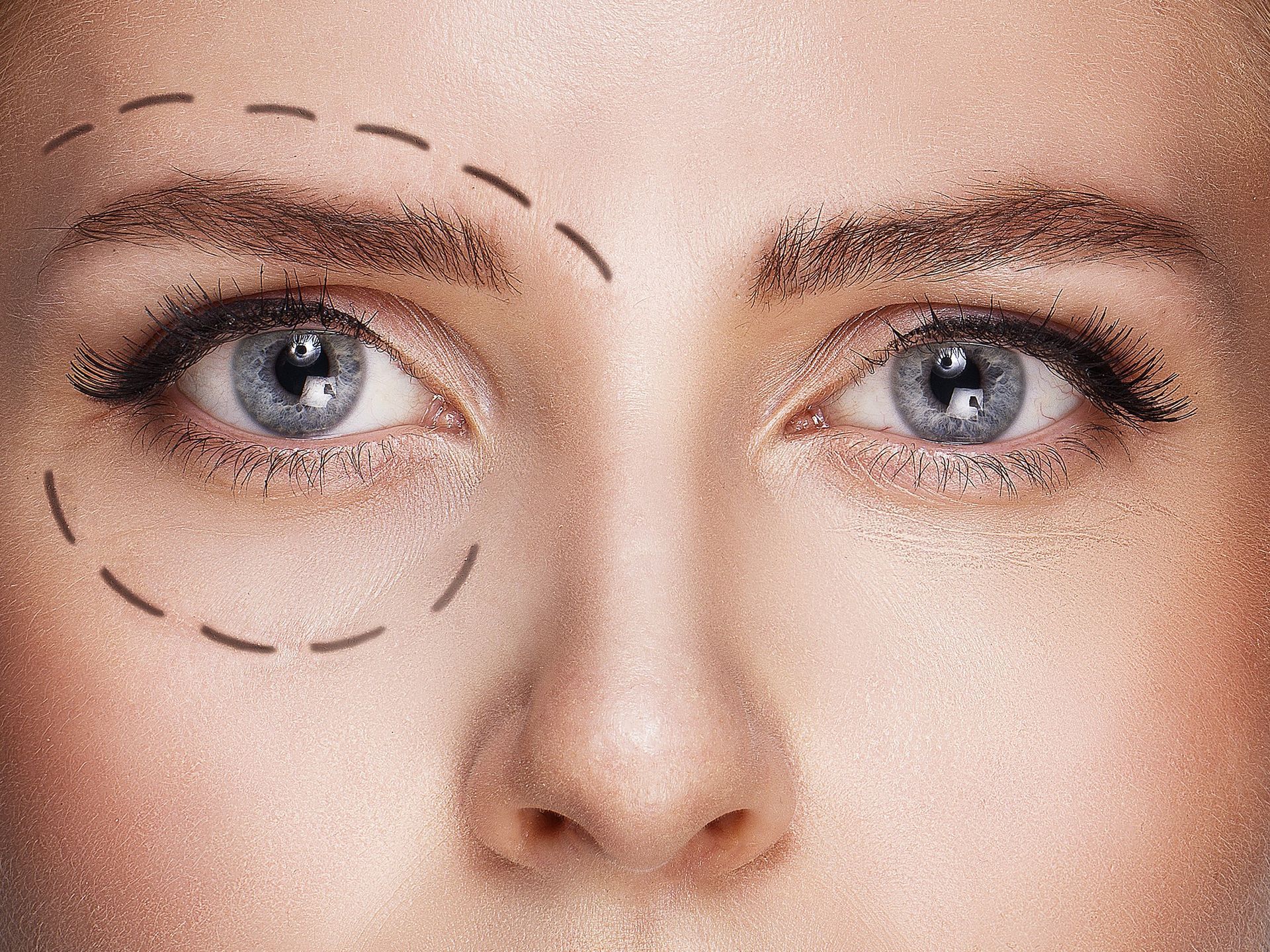 Illustration de la chirurgie esthétique du regard et des paupières, des procédures visant à améliorer l'apparence esthétique des yeux et des contours des paupières