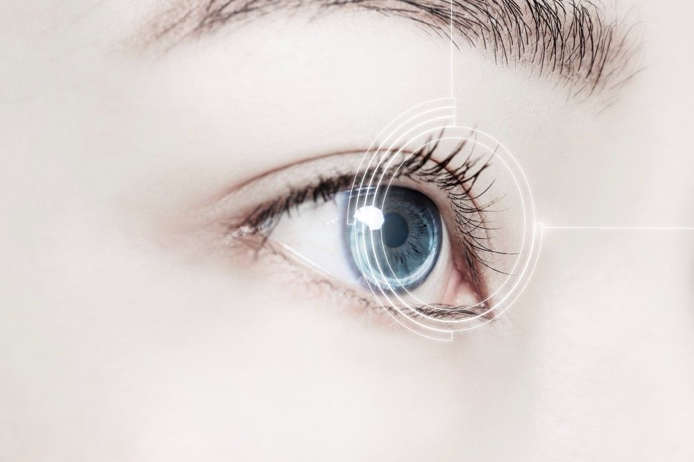 Illustration du glaucome aigu par fermeture de l'angle (GAFA), une urgence médicale caractérisée par une augmentation soudaine de la pression intraoculaire