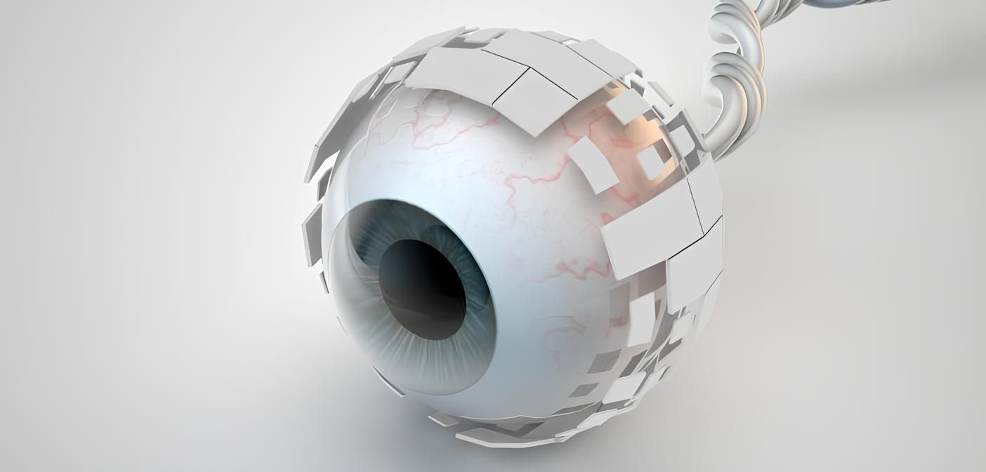 Illustration d'implants multifocaux intraoculaires, des lentilles utilisées lors de chirurgies de remplacement du cristallin pour corriger la vision à plusieurs distances focales