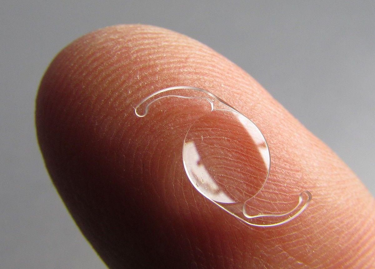 Illustration d'implants toriques intraoculaires, des lentilles utilisées lors de chirurgies de remplacement du cristallin pour corriger l'astigmatisme