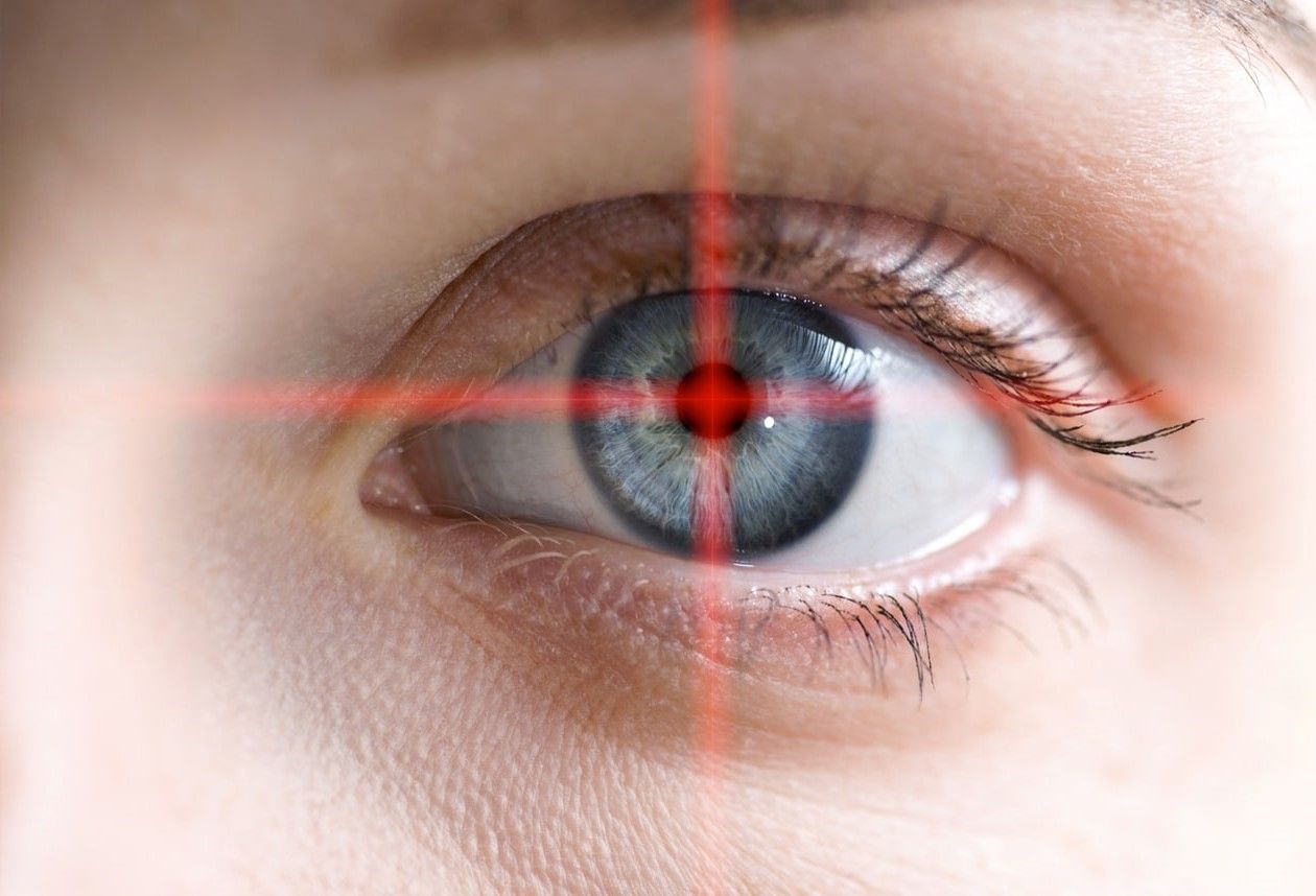 Illustration de la trabéculoplastie sélective au laser (SLT), une procédure utilisée pour traiter le glaucome en améliorant la drainage de l'humeur aqueuse