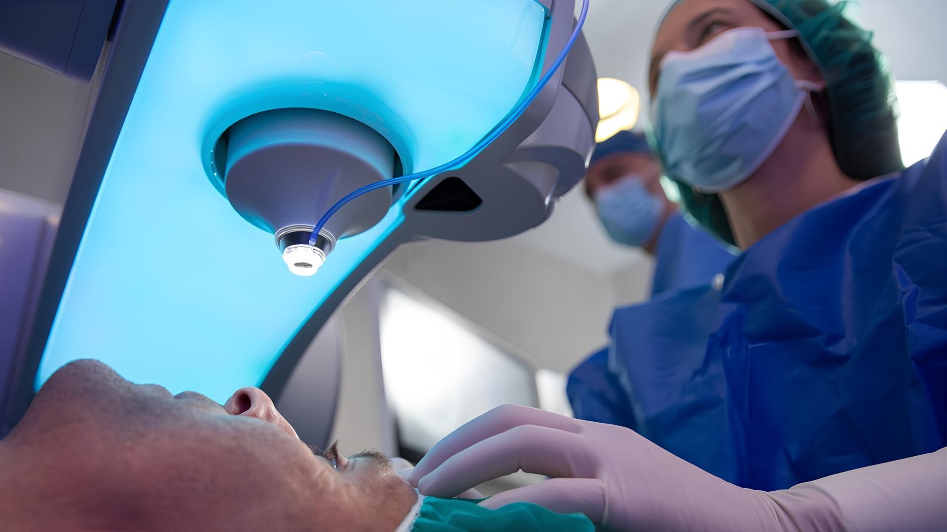 Illustration de la chirurgie réfractive LASIK effectuée avec le laser femtoseconde, une technique de correction de la vision au laser utilisée pour traiter la myopie, l'hypermétropie et l'astigmatisme