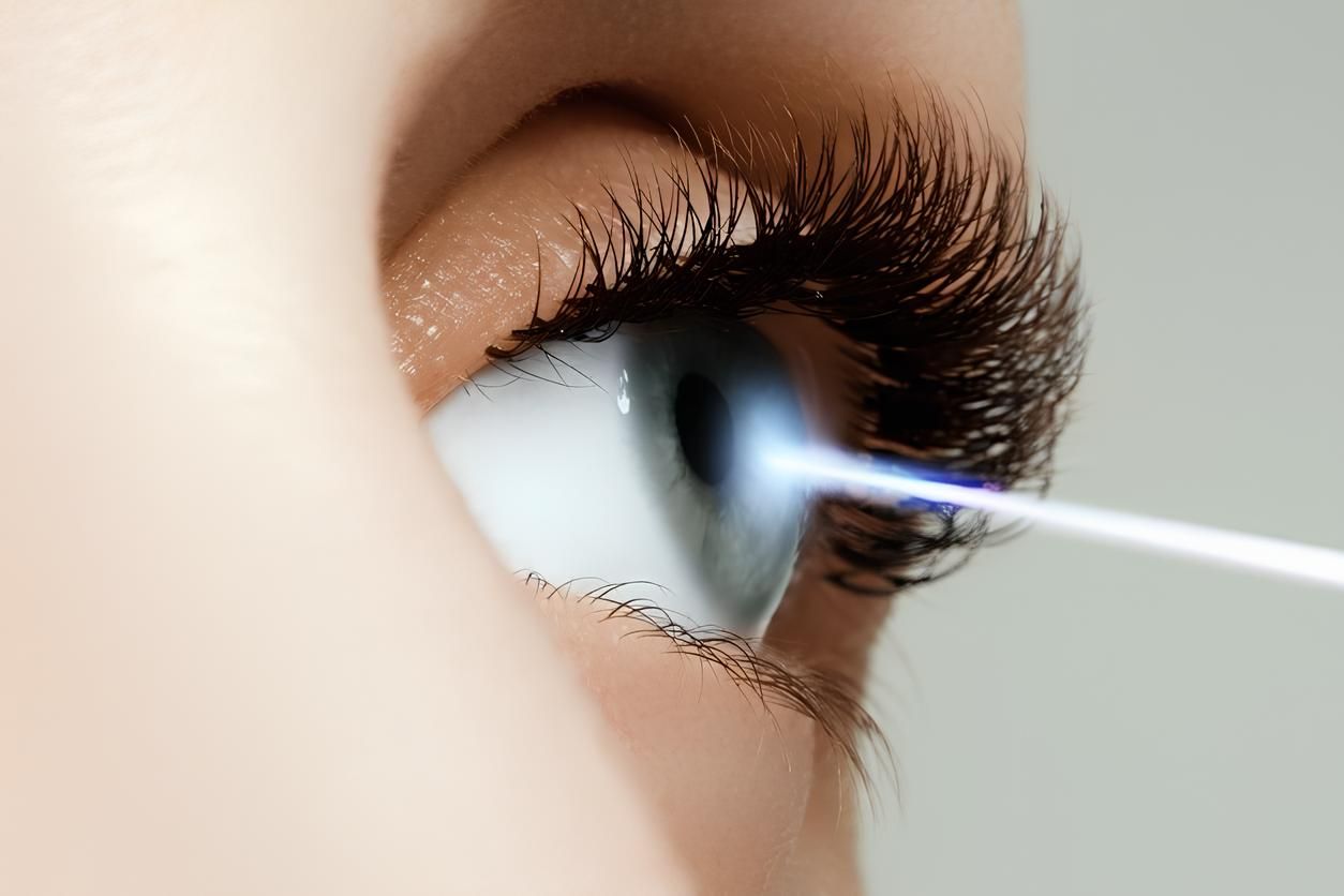 Illustration du PresbyLASIK, une technique de chirurgie réfractive pour corriger la presbytie et d'autres troubles de la vision liés à l'âge