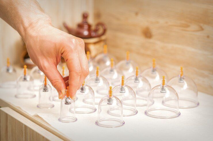Hijama enfant Hijama enfant