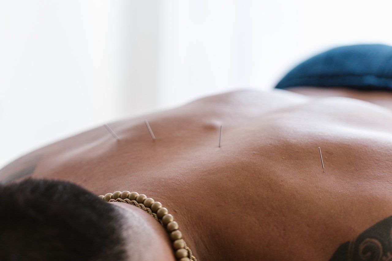 Hijama sèche acupuncture Hijama sèche acupuncture