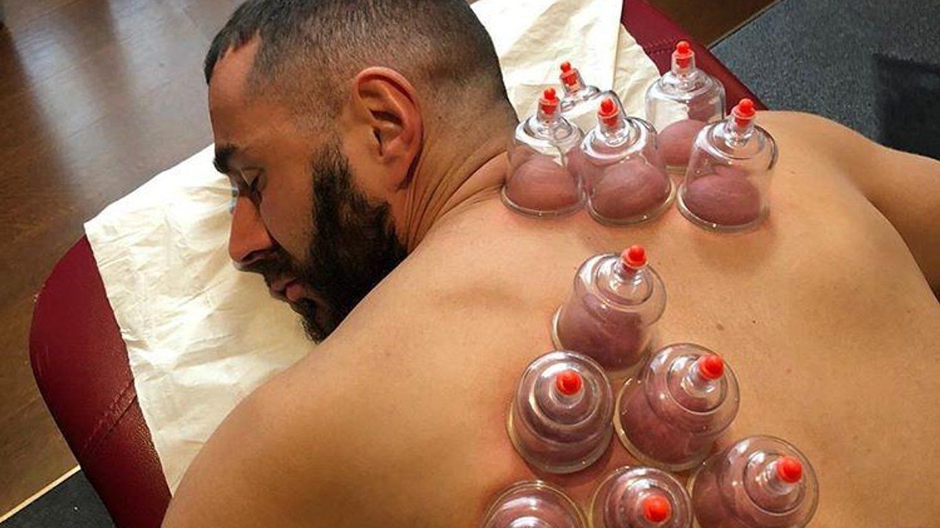 Hijama sportif Hijama sportif