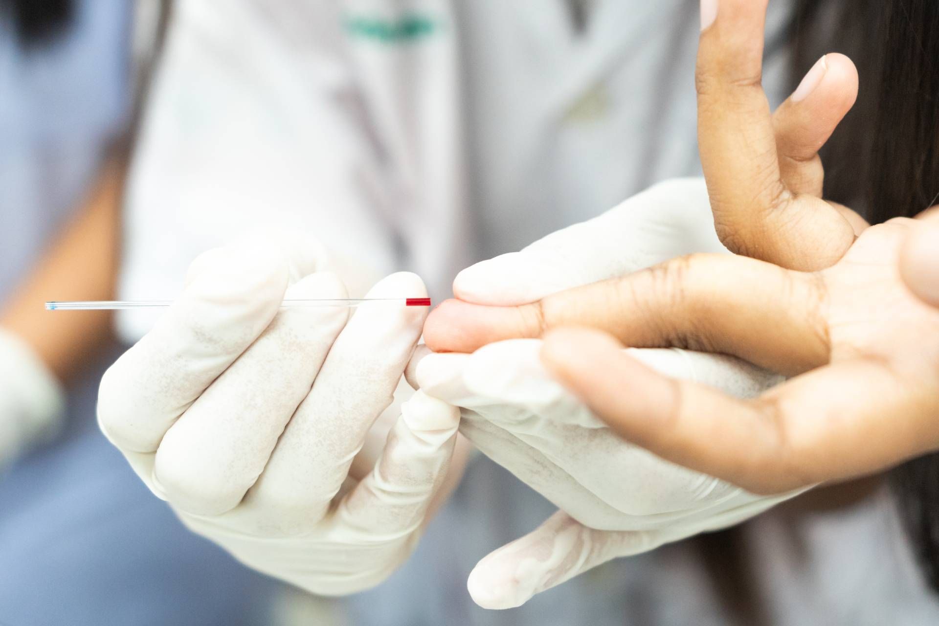 Un operatore sanitario in guanti bianchi punge il dito di una persona con una sottile lancetta per prelevare un campione di sangue. La scena trasmette precisione clinica.