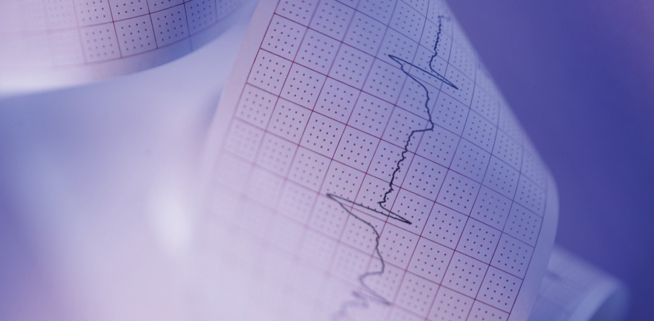 Ein Bild, EKG-Kurve, Ausdruck
