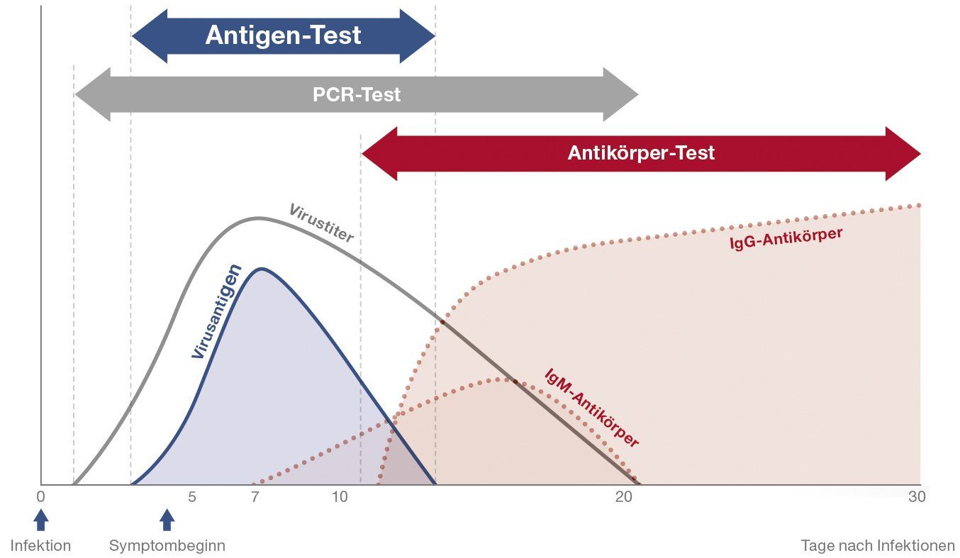 ein Bild, moderne Desinfektionsmittelspender mit Metallsockel