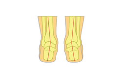 Flat Foot