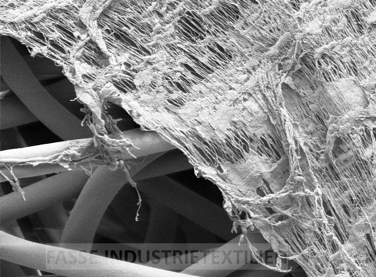 ePTFE-Membrane unterm dem REM-Mikroskop