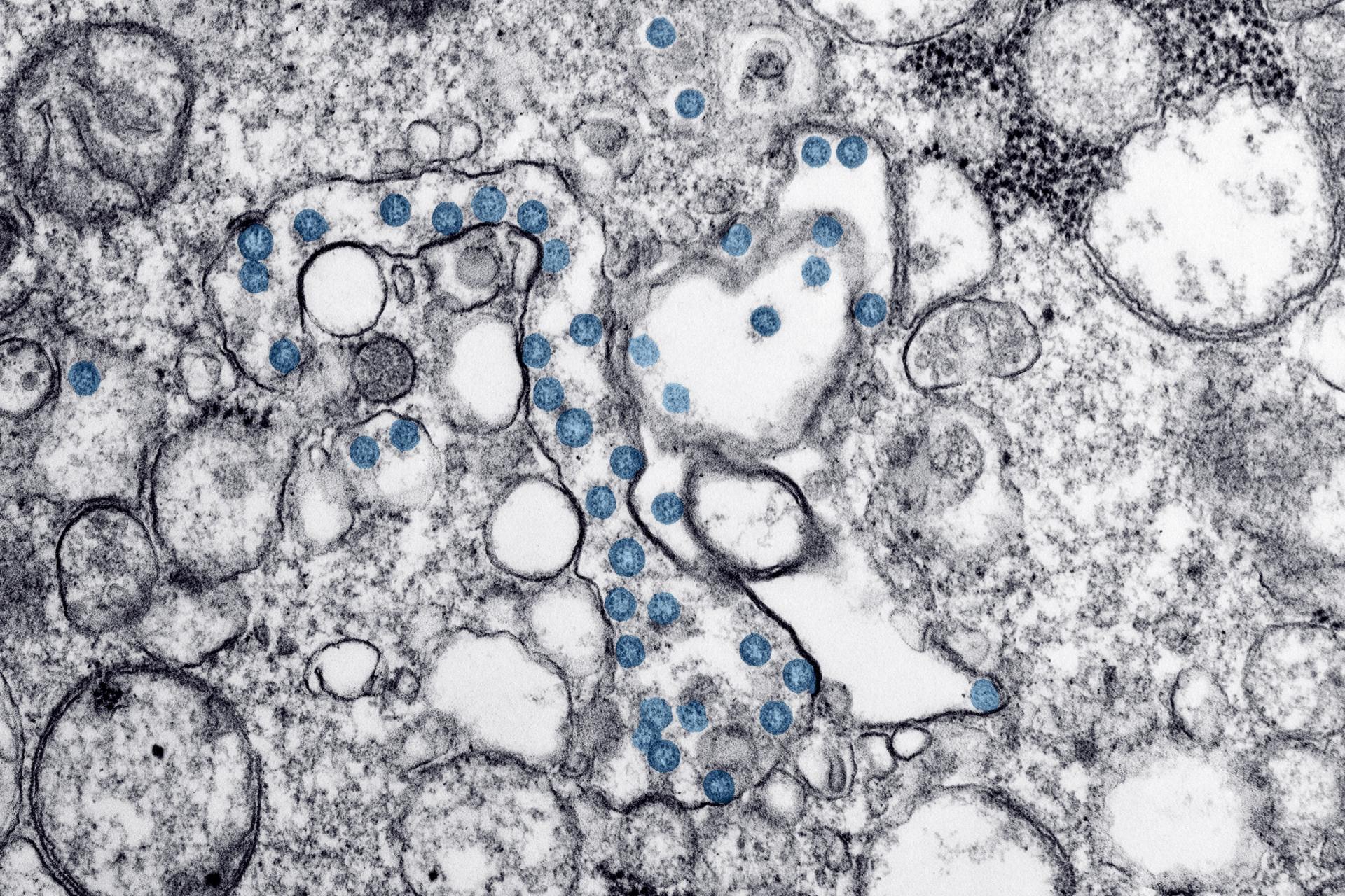 STUDIE Chlordioxid-Lösungen inaktivieren den Coronavirus STUDIE Chlordioxid-Lösungen inaktivieren den Coronavirus