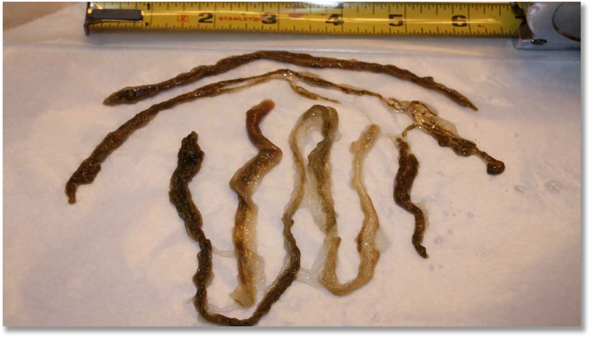 Rope Worm, Seilwurm, Homo funis vermis, funis vermis - MMS Rope Worm, Seilwurm, Homo funis vermis, funis vermis - MMS