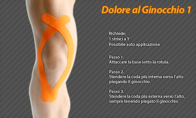 dolore al ginocchio