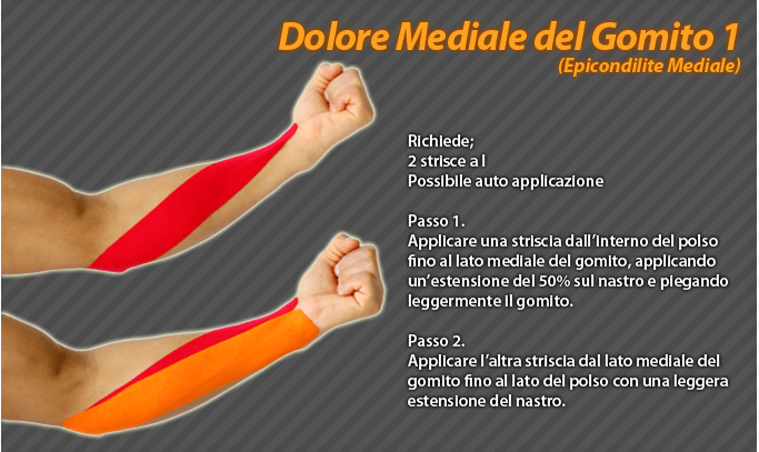 dolore mediale del gomito
