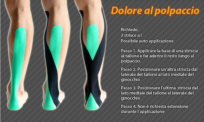 dolore al polpaccio