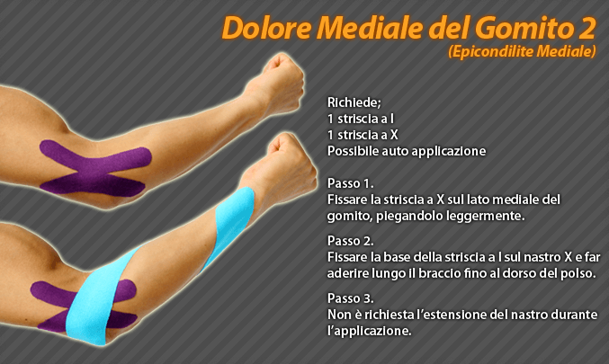 dolore mediale del gomito