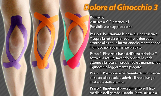 dolore al ginocchio