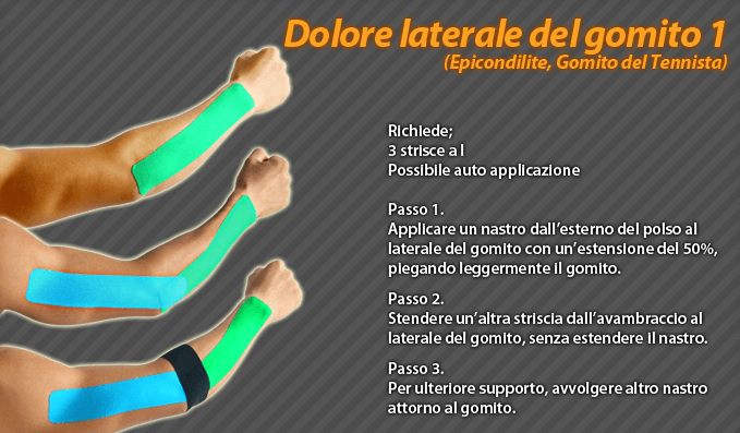 dolore laterale del gomito