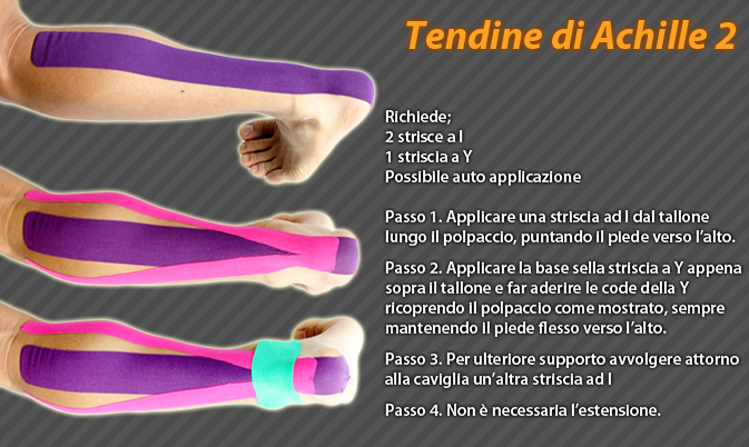 tendine di achille