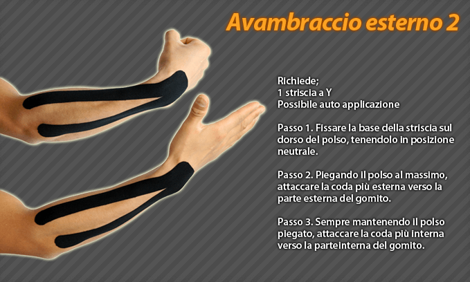 avambraccio