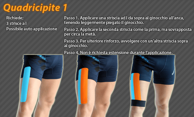 quadricipite