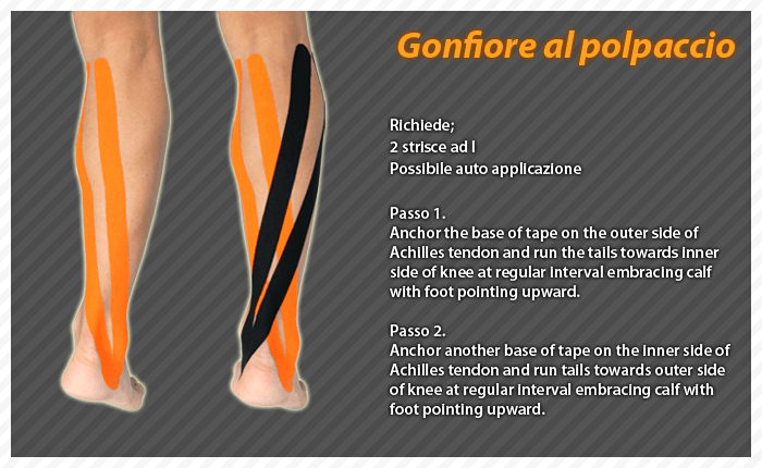 gonfiore al polpaccio