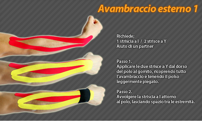avambraccio esterno