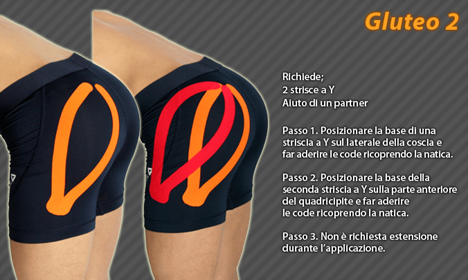gluteo
