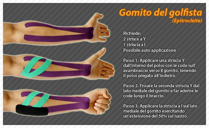 gomito del golfista epitrocleite